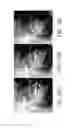 Fig. 15 - Method and system for analyzing craniofacial complex images