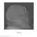 Fig. 17 - Method and system for analyzing craniofacial complex images
