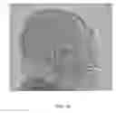 Fig. 18 - Method and system for analyzing craniofacial complex images