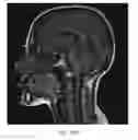 Fig. 20 - Method and system for analyzing craniofacial complex images