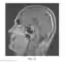 Fig. 22 - Method and system for analyzing craniofacial complex images
