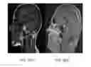 Fig. 23 - Method and system for analyzing craniofacial complex images