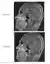 Fig. 24 - Method and system for analyzing craniofacial complex images