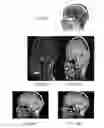 Fig. 25 - Method and system for analyzing craniofacial complex images