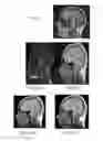 Fig. 26 - Method and system for analyzing craniofacial complex images