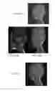 Fig. 27 - Method and system for analyzing craniofacial complex images