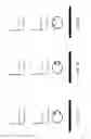 Fig. 03 - VESTIBULAR TESTING