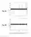 Fig. 05 - WAVELET ANALYSIS IN NEURO DIAGNOSTICS