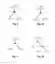 Fig. 06 - WAVELET ANALYSIS IN NEURO DIAGNOSTICS