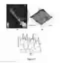 Fig. 06 - FUNCTIONAL NEAR-INFRARED FLUORESCENCE LYMPHATIC MAPPING FOR DIAGNOSING, ACCESSING, MONITORING AND DIRECTING THERAPY OF LYMPHATIC DISORDERS
