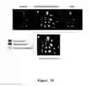 Fig. 20 - FUNCTIONAL NEAR-INFRARED FLUORESCENCE LYMPHATIC MAPPING FOR DIAGNOSING, ACCESSING, MONITORING AND DIRECTING THERAPY OF LYMPHATIC DISORDERS