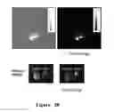 Fig. 21 - FUNCTIONAL NEAR-INFRARED FLUORESCENCE LYMPHATIC MAPPING FOR DIAGNOSING, ACCESSING, MONITORING AND DIRECTING THERAPY OF LYMPHATIC DISORDERS