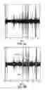 Fig. 15 - Meal detection devices and methods