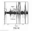 Fig. 16 - Meal detection devices and methods