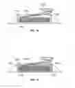 Fig. 10 - Pressure sensing implant