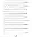 Fig. 02 - ARTIFACT AS A FEATURE IN NEURO DIAGNOSTICS