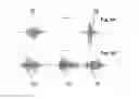Fig. 05 - ARTIFACT AS A FEATURE IN NEURO DIAGNOSTICS