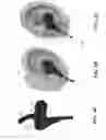 Fig. 05 - SYSTEM AND METHOD FOR TRACKING BIOLOGICAL AGE OVER TIME BASED UPON HEART RATE VARIABILITY USING EARPHONES WITH BIOMETRIC SENSORS