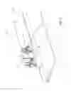 Fig. 04 - Movable shield for reducing radiation exposure of medical personnel