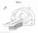 Fig. 03 - X-RAY COMPUTED TOMOGRAPHY APPARATUS