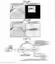 Fig. 08 - X-ray diagnostic apparatus to identify a target in x-ray images