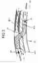 Fig. 03 - DEVICE AND METHOD FOR USING IVUS DATA TO CHARACTERIZE AND EVALUATE A VASCULAR GRAFT CONDITION