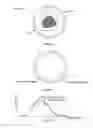 Fig. 05 - Ultrasound waveform tomography method and system