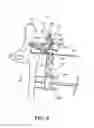 Fig. 07 - Adjustable orthopaedic joint distractor