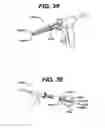 Fig. 22 - Systems and methods for spinal surgery