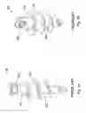 Fig. 02 - Suture-anchoring implanted medical devices engineered from bioresorbable metal alloys