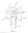 Fig. 08 - Method and apparatus for attaching tissue to bone, including the provision and use of a novel knotless suture anchor system, including a retractable sheath