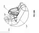 Fig. 40 - Method and apparatus for attaching tissue to bone, including the provision and use of a novel knotless suture anchor system, including a retractable sheath