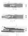 Fig. 52 - Method and apparatus for attaching tissue to bone, including the provision and use of a novel knotless suture anchor system, including a retractable sheath