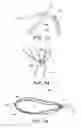Fig. 07 - Adjustable suture-button construct for ankle syndesmosis repair