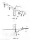 Fig. 10 - Adjustable suture-button construct for ankle syndesmosis repair