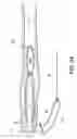 Fig. 15 - Adjustable suture-button construct for ankle syndesmosis repair