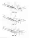 Fig. 07 - Suture assembly including a suture clip