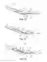 Fig. 08 - Suture assembly including a suture clip
