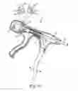 Fig. 10 - Suture assembly including a suture clip