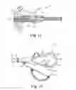Fig. 13 - Suture assembly including a suture clip