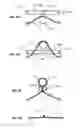 Fig. 05 - Fascial harvester device