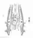 Fig. 11 - Surgical clip applier