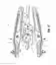 Fig. 15 - Surgical clip applier
