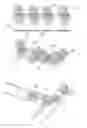 Fig. 01 - Embolisation systems