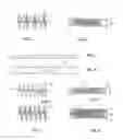 Fig. 02 - Embolisation systems
