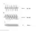 Fig. 05 - Embolisation systems