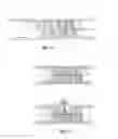 Fig. 10 - Embolisation systems