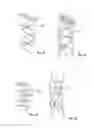 Fig. 19 - Embolisation systems