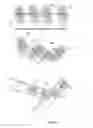 Fig. 22 - Embolisation systems