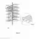 Fig. 34 - Embolisation systems